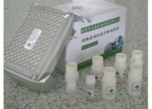 Aͪzy(c)ԇע(c)g(sh)ָ(do)ԭt